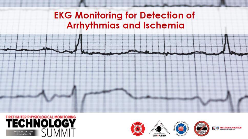 EKG Monitoring for Detection of Arrhythmias and Ischemia